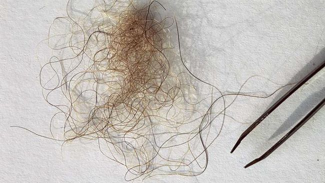 Alih-alih bukti keberadaan Yeti, rambut yang ditemukan di Himalaya ternyata punya DNA makhluk berikut.